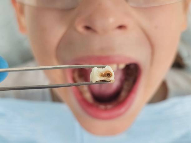 Best Emergency Care for Gum Disease in Fuquay Varina, NC